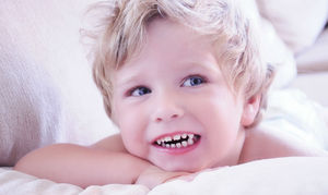 Possíveis causas de ranger de dentes