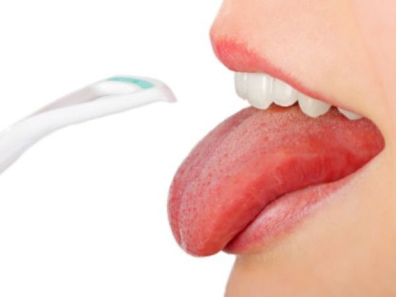 Como remover a placa da língua O que significa remover a placa na língua
