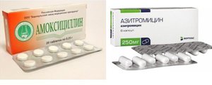 Tratamento de fluxo dentário