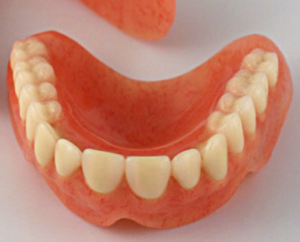 O custo das próteses dentárias