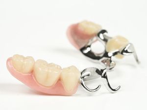 Características da instalação de próteses