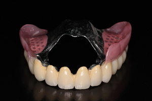 Como fazer dentaduras