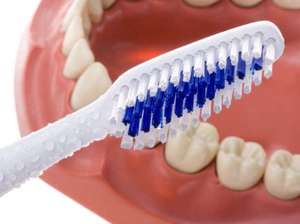 Como cuidar de dentaduras