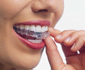 O preço das próteses de silicone