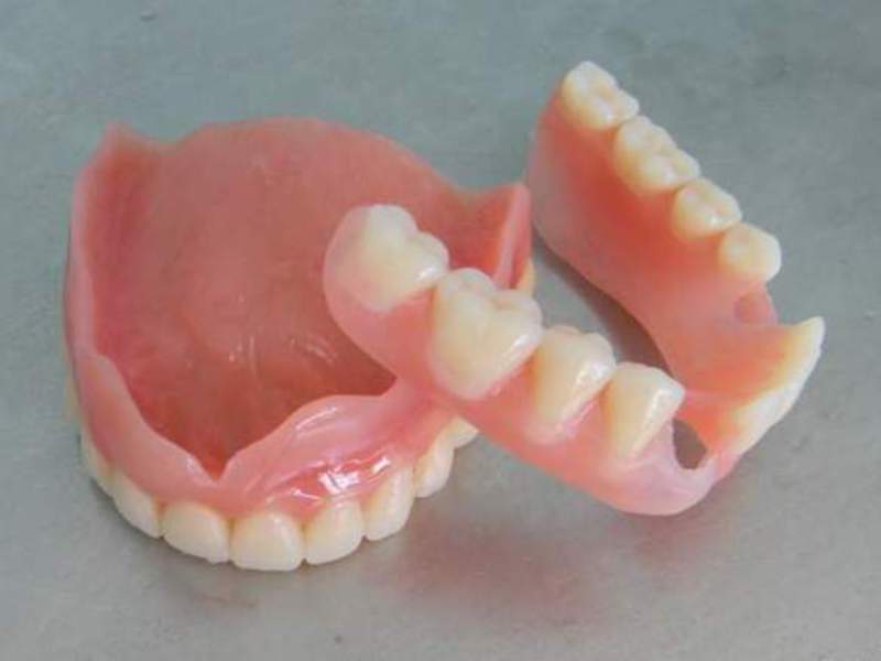 Instalação de próteses de silicone