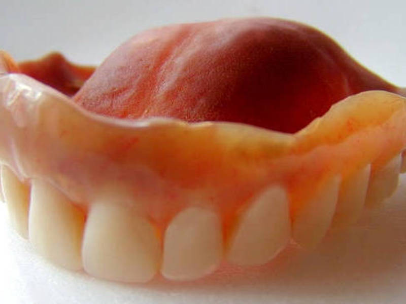 Técnicas de fabricação de próteses de silicone