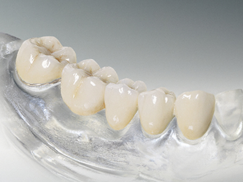 Benefícios de dentaduras de silicone