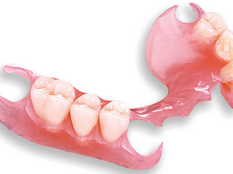 O que são próteses de silicone removíveis