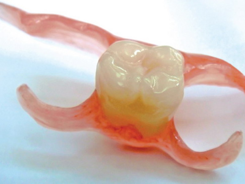 Desvantagens das dentaduras de silicone